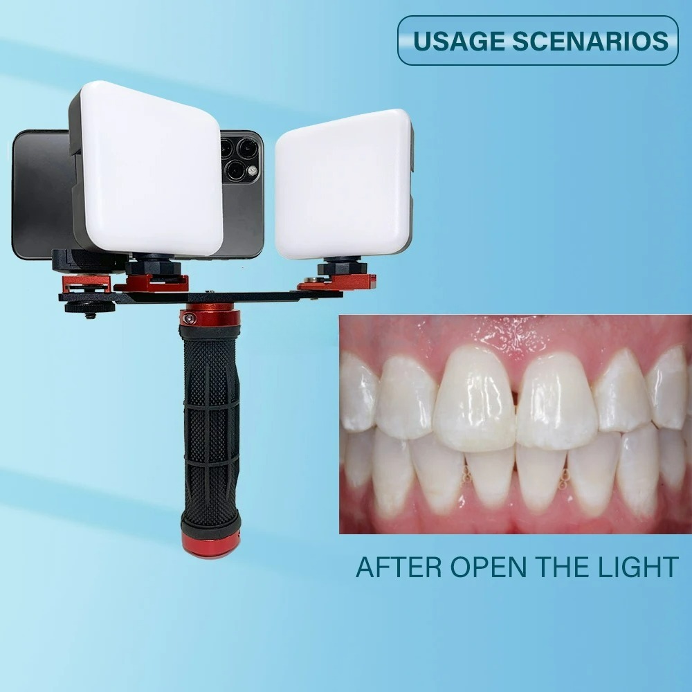 ضوء تصوير الأسنان للهاتف مع تق - مراجعة Photography Dental وسعره