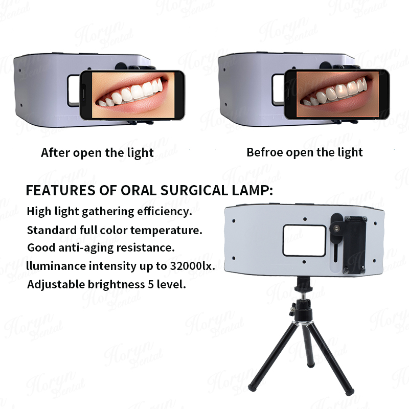 مصباح فلاش الأسنان معدات التصو - مراجعة Photography Dental وسعره